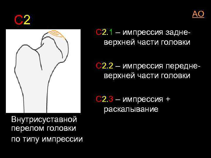 AO С 2. 1 – импрессия задневерхней части головки С 2. 2 – импрессия