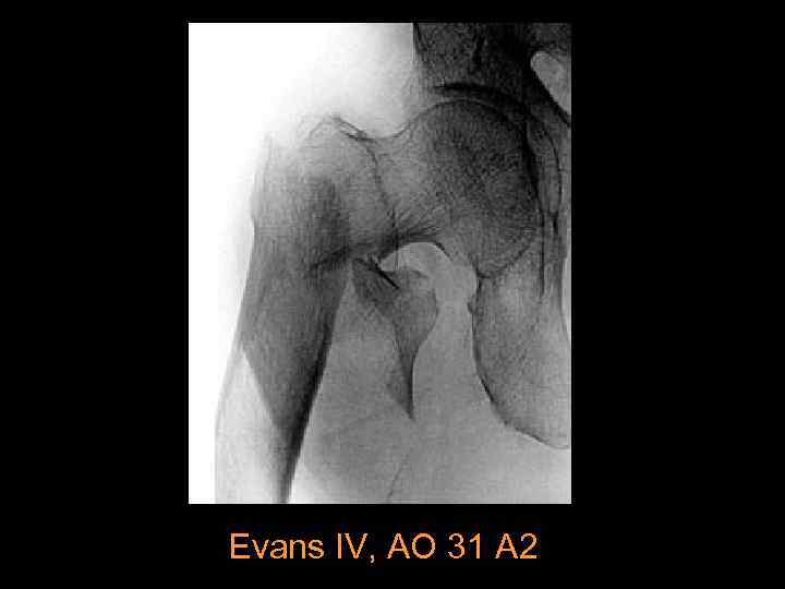 Evans IV, AO 31 A 2 