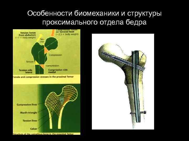 Особенности биомеханики и структуры проксимального отдела бедра 