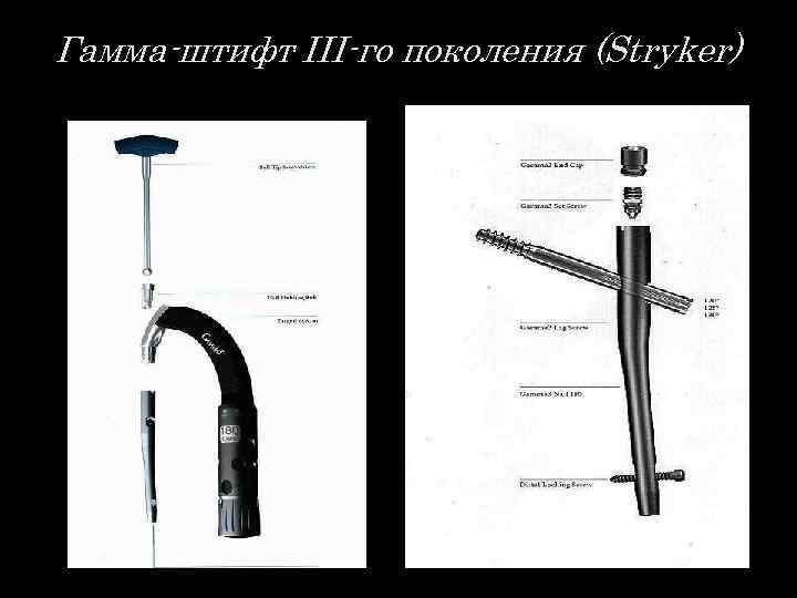 Гамма-штифт III-го поколения (Stryker) 