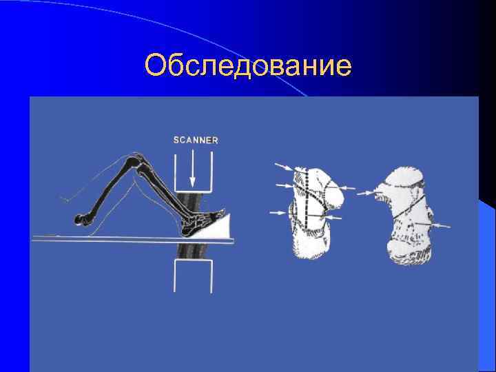 Обследование 