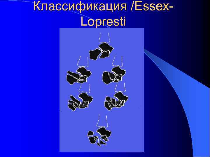 Классификация /Essex. Lopresti 