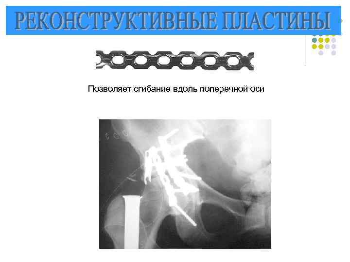 Позволяет сгибание вдоль поперечной оси 