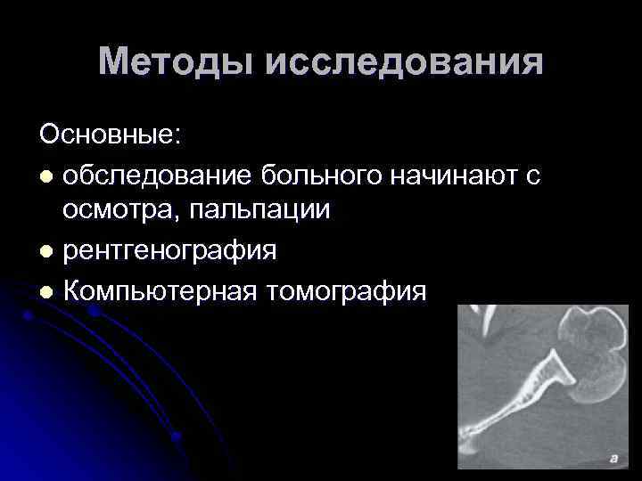Методы исследования Основные: l обследование больного начинают с осмотра, пальпации l рентгенография l Компьютерная