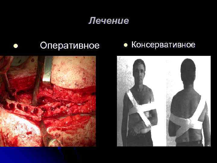Лечение l Оперативное l Консервативное 