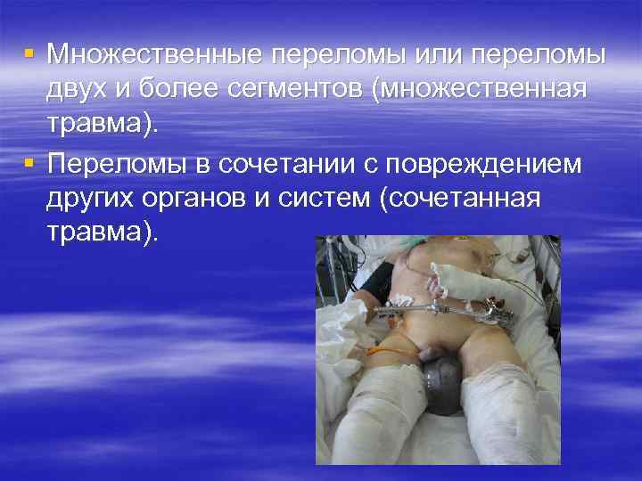 § Множественные переломы или переломы двух и более сегментов (множественная травма). § Переломы в