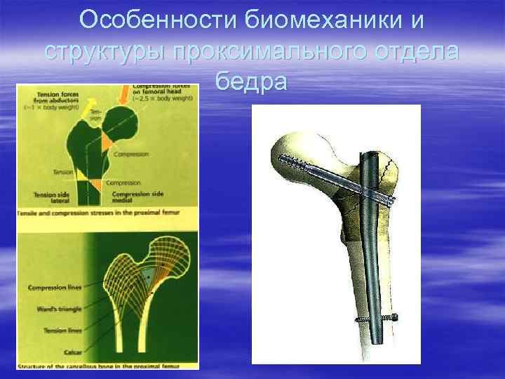 Особенности биомеханики и структуры проксимального отдела бедра 
