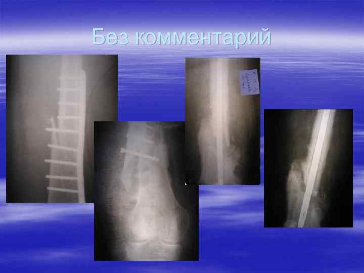 Без комментарий 