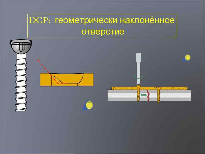 DCP: геометрически наклонённое отверстие 