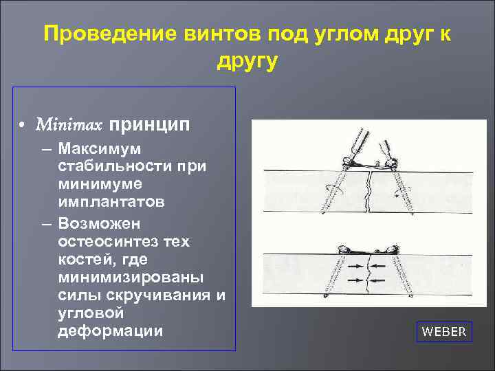 Проведение винтов под углом друг к другу • Minimax принцип – Максимум стабильности при