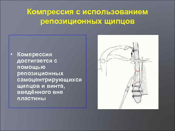 Относительная стабильность перелом thumbnail