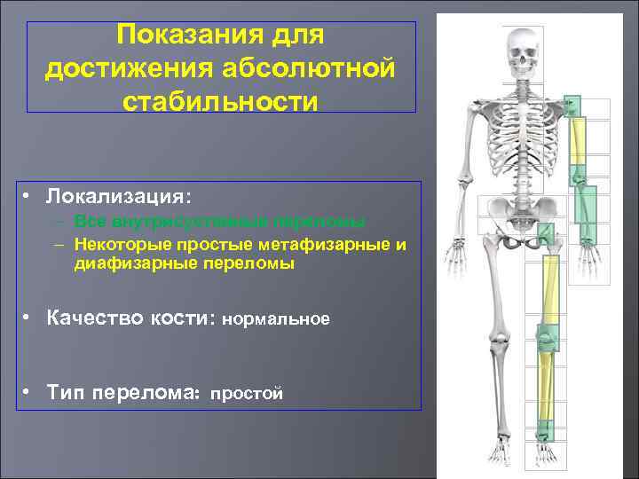 Кости качество