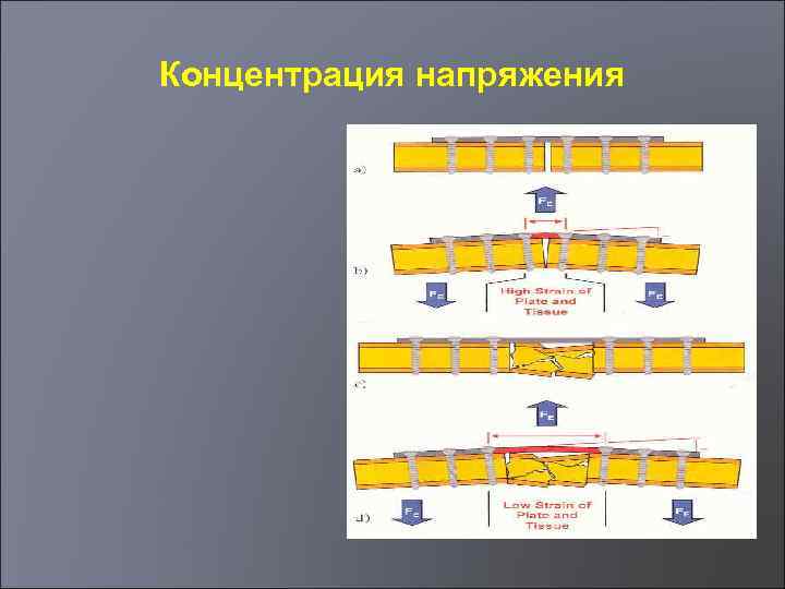 Концентрация напряжения 