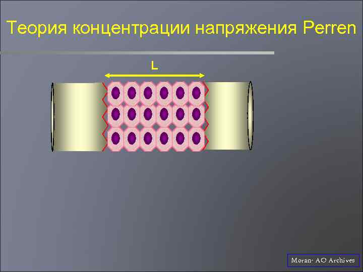 Теория концентрации напряжения Perren L Moran- AO Archives 