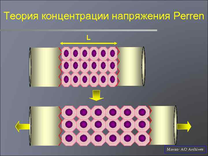 Теория концентрации напряжения Perren L Moran- AO Archives 