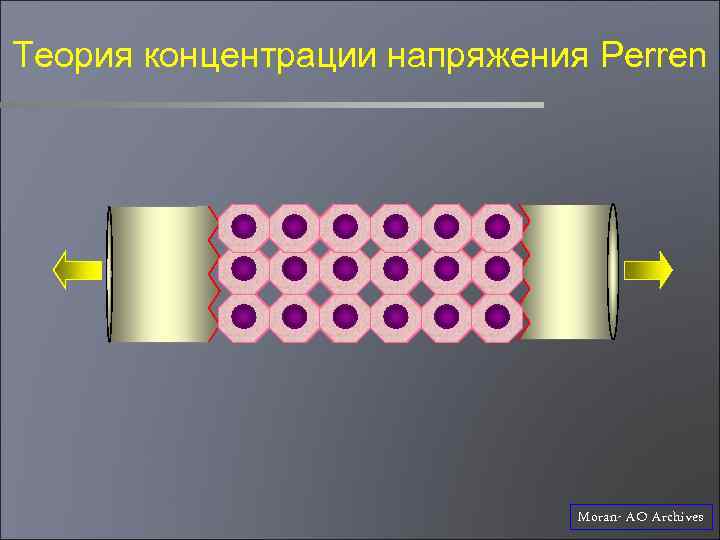 Теория концентрации напряжения Perren Moran- AO Archives 