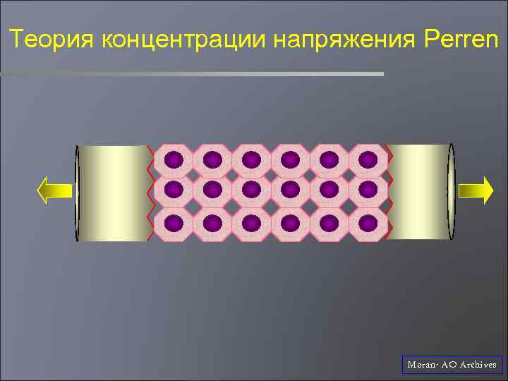 Теория концентрации напряжения Perren Moran- AO Archives 