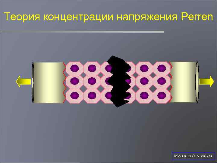 Теория концентрации напряжения Perren Moran- AO Archives 