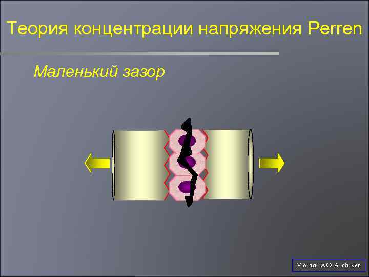 Теория концентрации напряжения Perren Маленький зазор Moran- AO Archives 