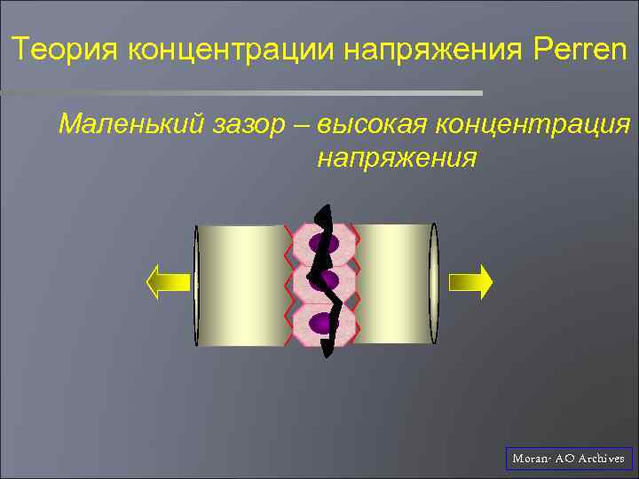 Теория концентрации напряжения Perren Маленький зазор – высокая концентрация напряжения Moran- AO Archives 