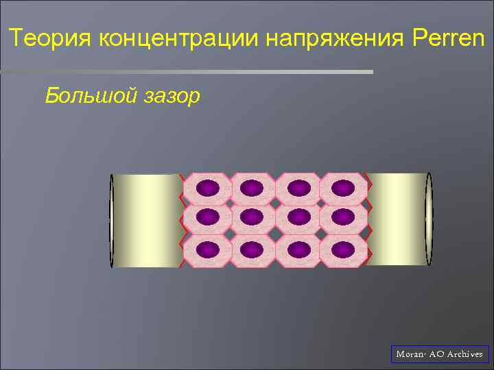 Теория концентрации напряжения Perren Большой зазор Moran- AO Archives 