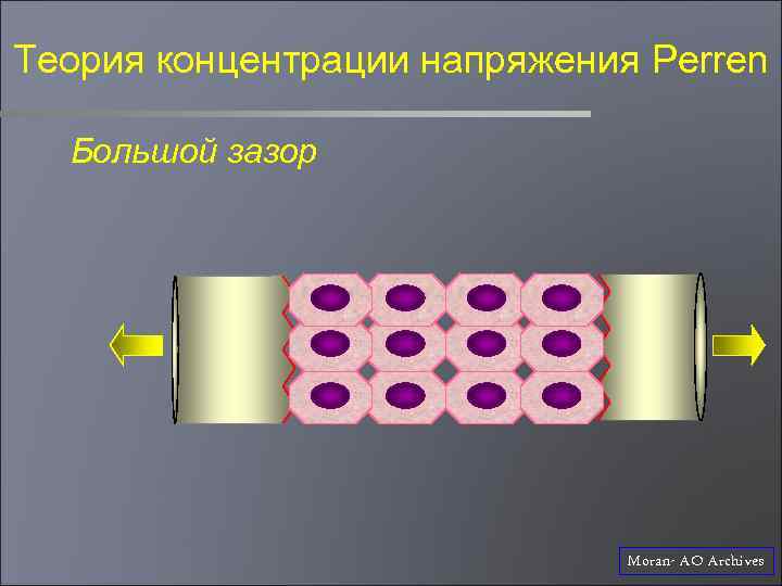 Теория концентрации напряжения Perren Большой зазор Moran- AO Archives 