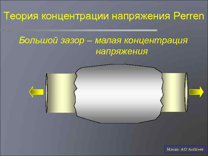 Теория концентрации напряжения Perren Большой зазор – малая концентрация напряжения Moran- AO Archives 