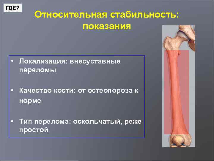 ГДЕ? Относительная стабильность: показания • Локализация: внесуставные переломы • Качество кости: от остеопороза к