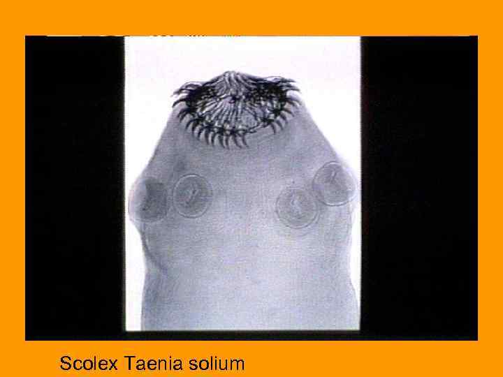 Scolex Taenia solium 