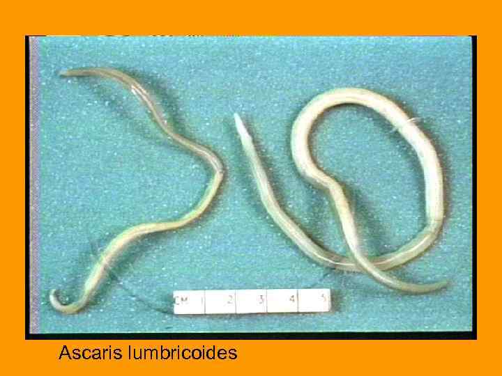 Ascaris lumbricoides 