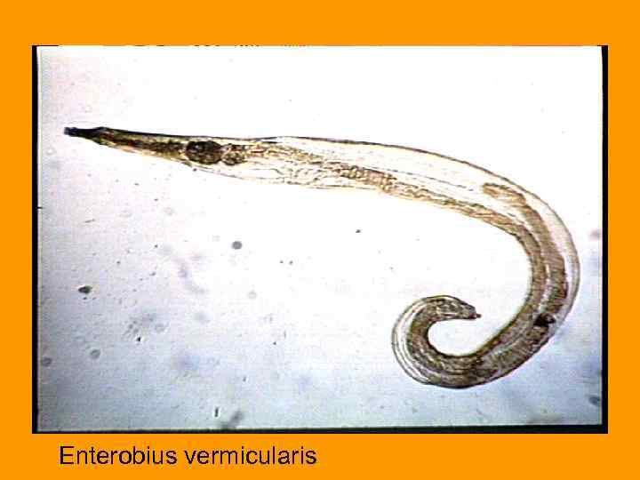 Enterobius vermicularis что это. Тотальный препарат Enterobius vermicularis. Enterobius vermicularis препарат. 17. Enterobius vermicularis. Препарат. Обнаружены яйца Enterobius vermicularis.