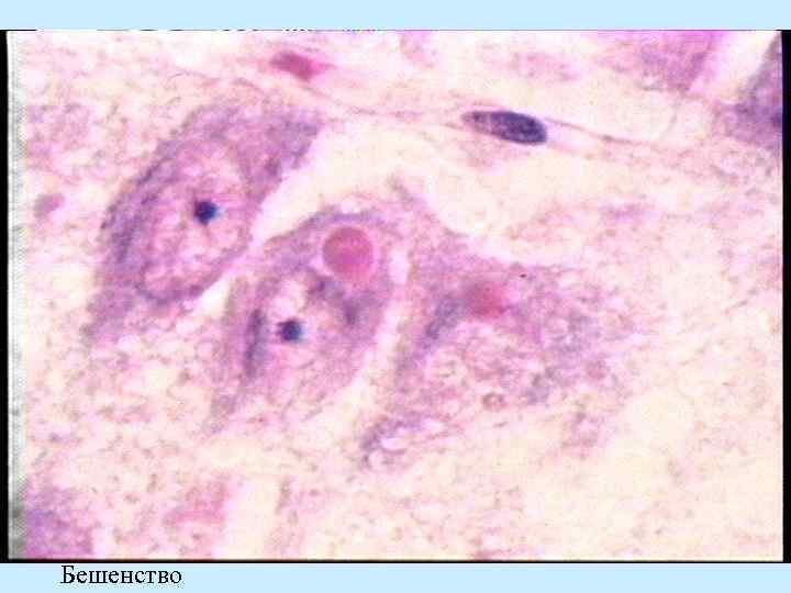 Бешенство 