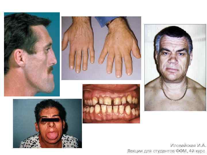 Иловайская И. А. Лекции для студентов ФФМ, 4 й курс 