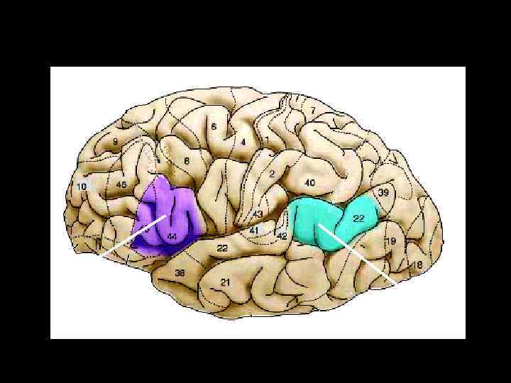 область Брока область Вернике 