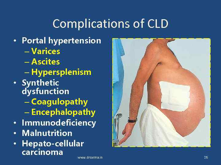 Complications of CLD • Portal hypertension – Varices – Ascites – Hypersplenism • Synthetic