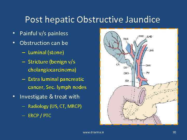 Post hepatic Obstructive Jaundice • Painful v/s painless • Obstruction can be – Luminal