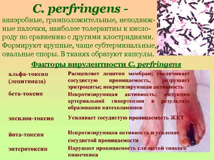 C. perfringens анаэробные, грамположительные, неподвижные палочки, наиболее толерантны к кислороду по сравнению с другими