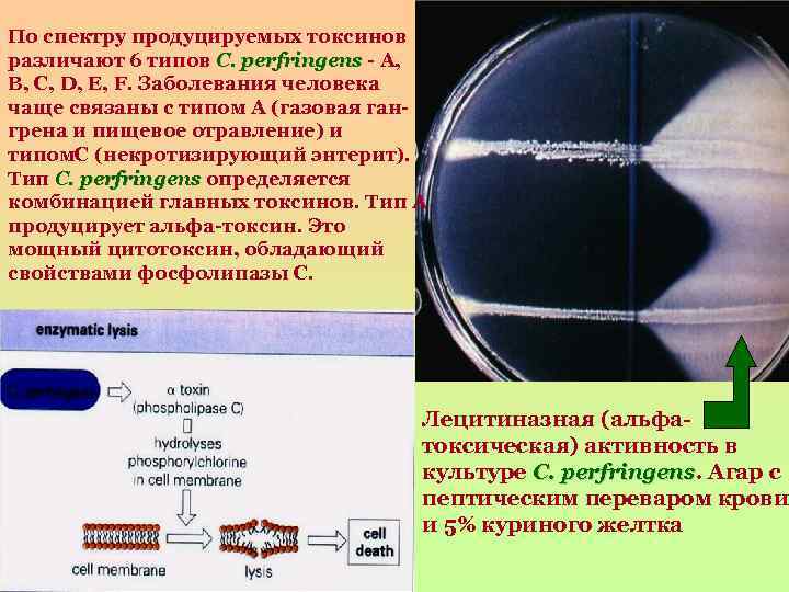 По спектру продуцируемых токсинов различают 6 типов C. perfringens - А, В, С, D,