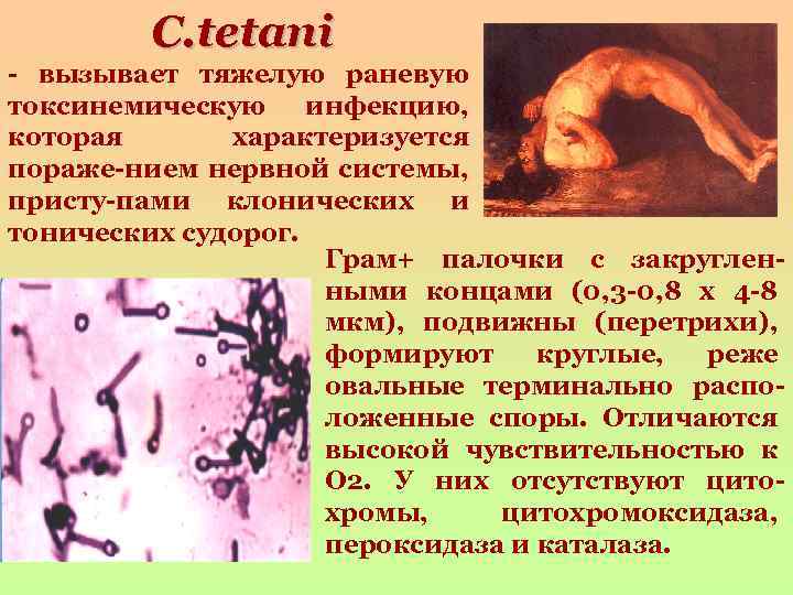 C. tetani - вызывает тяжелую раневую токсинемическую инфекцию, которая характеризуется пораже-нием нервной системы, присту-пами