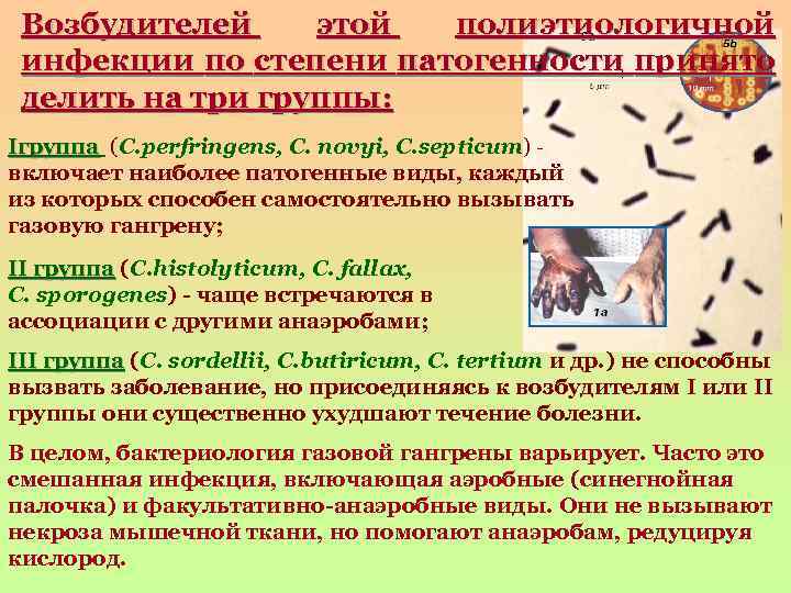 Возбудителей этой полиэтиологичной инфекции по степени патогенности принято делить на три группы: Iгруппа (C.