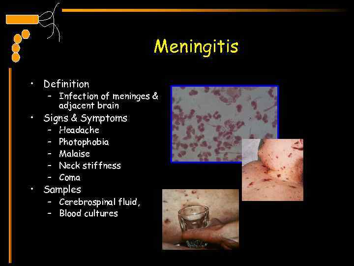 Meningitis • Definition – Infection of meninges & adjacent brain • Signs & Symptoms