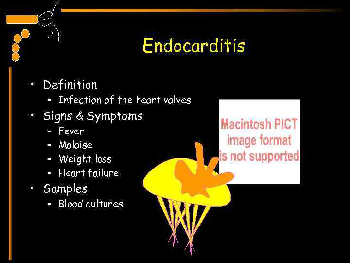 Endocarditis • Definition – Infection of the heart valves • Signs & Symptoms –