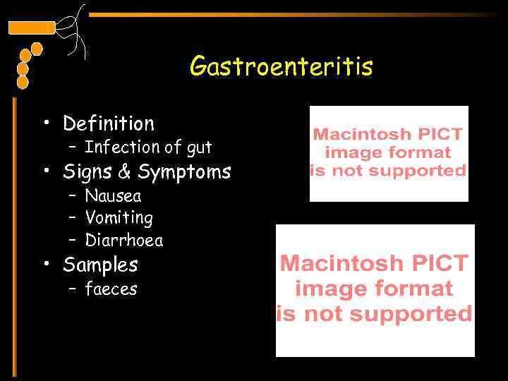 Gastroenteritis • Definition – Infection of gut • Signs & Symptoms – Nausea –