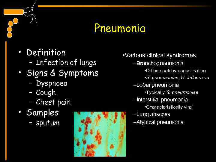 Pneumonia • Definition – Infection of lungs • Signs & Symptoms – Dyspnoea –