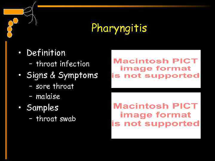 Pharyngitis • Definition – throat infection • Signs & Symptoms – sore throat –