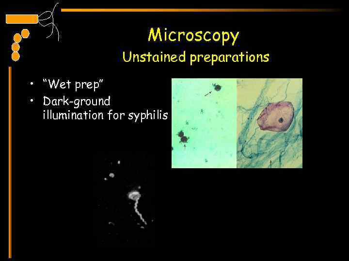 Microscopy Unstained preparations • “Wet prep” • Dark-ground illumination for syphilis 