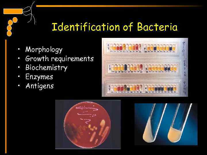 Identification of Bacteria • • • Morphology Growth requirements Biochemistry Enzymes Antigens 