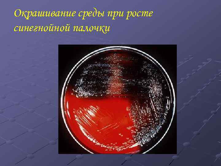 Окрашивание среды при росте синегнойной палочки 