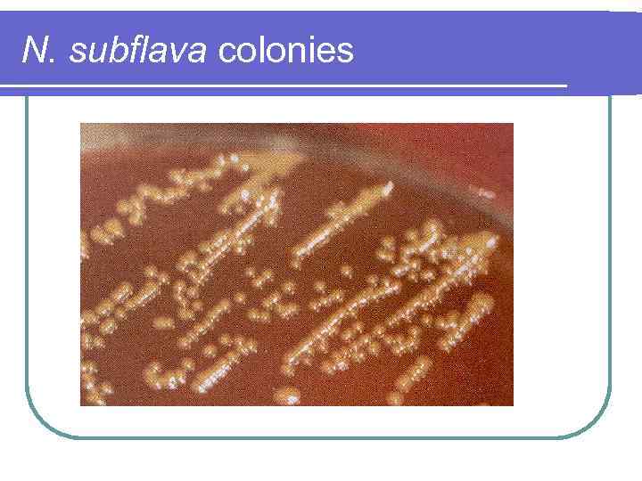 N. subflava colonies 