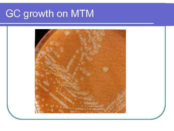 GC growth on MTM 